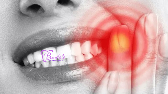 Pronto soccorso dentistico — Stomatološka ordinacija dr Maja Bundalo, Banja Luka