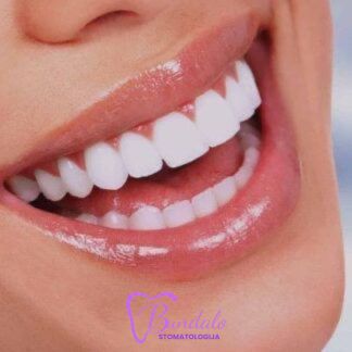 Dentalni turizam u Banjoj Luci — Stomatološka ordinacija dr Maja Bundalo, Banja Luka